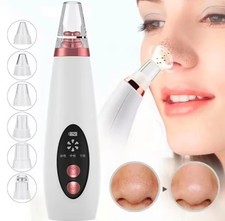 USB Blackhead Remover Vacuum – Pore Cleaner & Acne Extractor